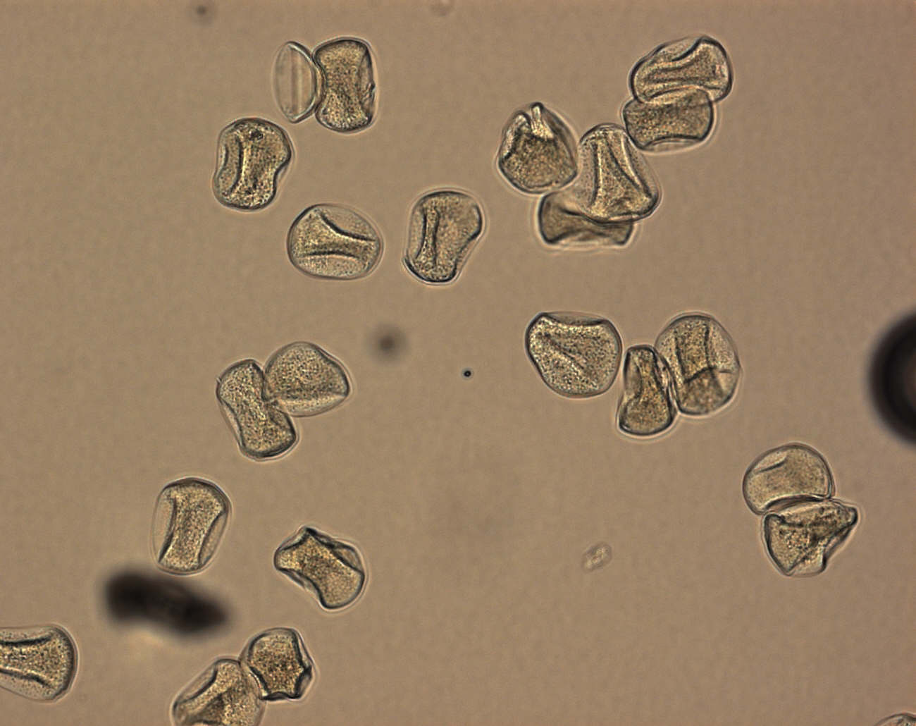 Фото пыльцы сосны под микроскопом